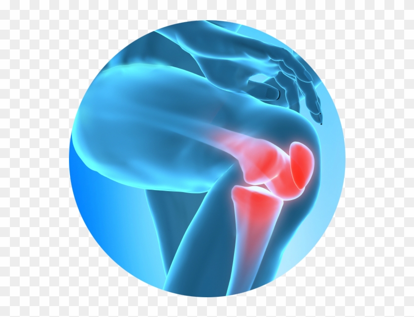 Chronic Joint Pain Slowing You Down Learn How Regenerative - Knee Pain In Png Clipart #563663