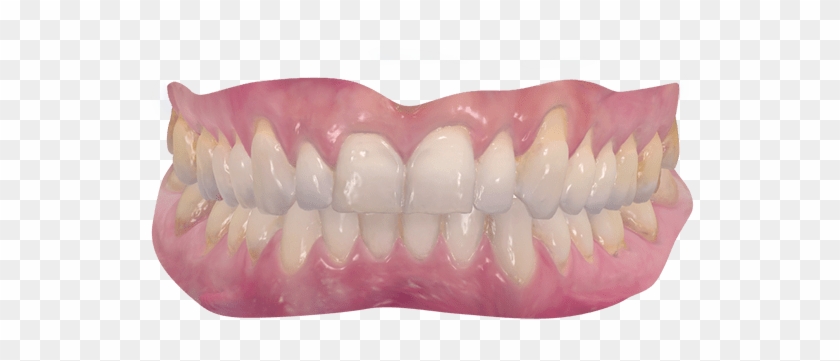 The Challenges Of The Digital Implant World - Realistic Mouth Transparent Clipart #568458