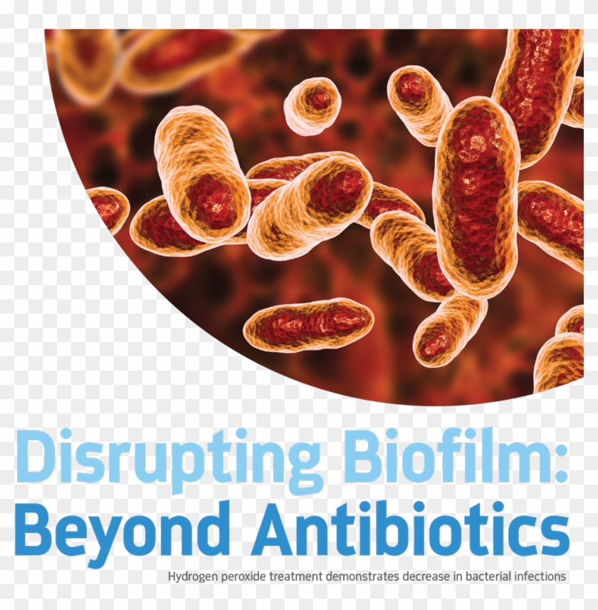 Dentaltown Magazine - Tannerella Forsythia Clipart #5622477