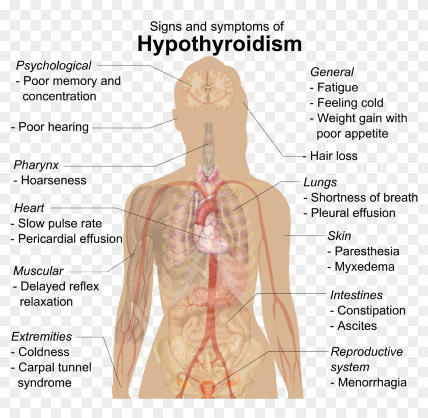 In Fact, If You Go To Your Psychiatrist Or Family Doctor - Differences Between Hypothyroidism And Hyperthyroidism Clipart
