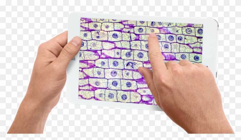 Edupad Tablet - Mitosis Real Clipart
