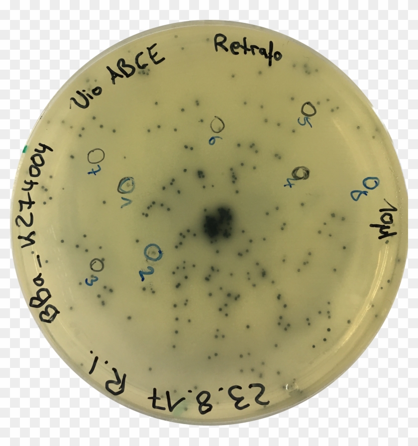 By Golden Gate Cloning The Peroxisomal Targeting Sequence - Circle Clipart #5646624