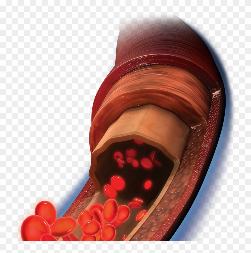 Tissue And Circulation - Medical Equipment Clipart #5688272