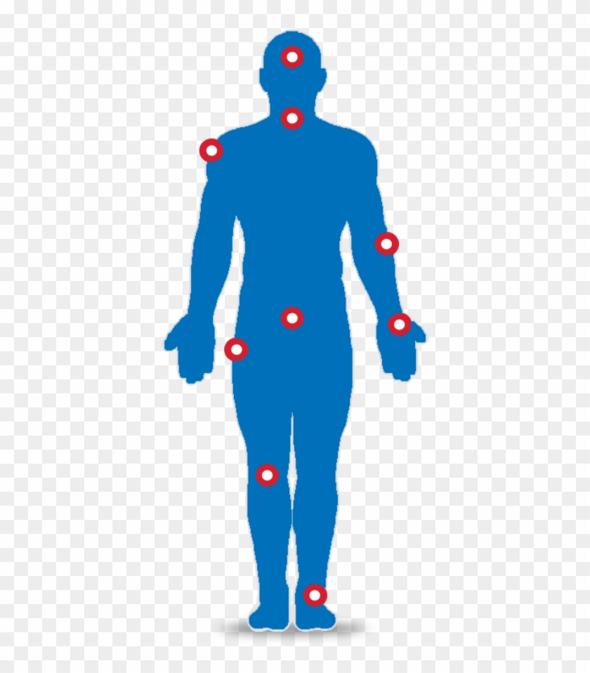 Areas Of Treatment - Illustration Clipart #5695741