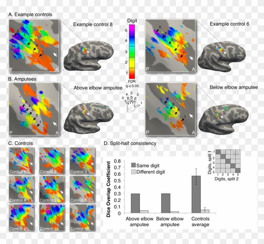 Makin Revealing Missing Hand Fig1 1 - Space Bar Clipart