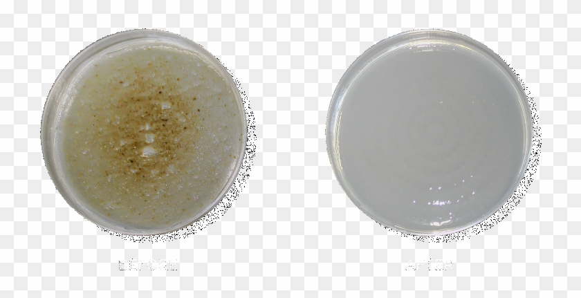 Pseudomonas Aeruginosa - Eye Shadow Clipart #5716793