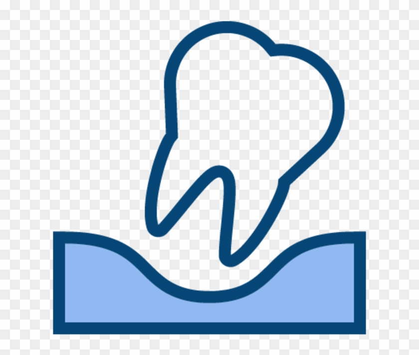 Wisdom Tooth Removal Clipart
