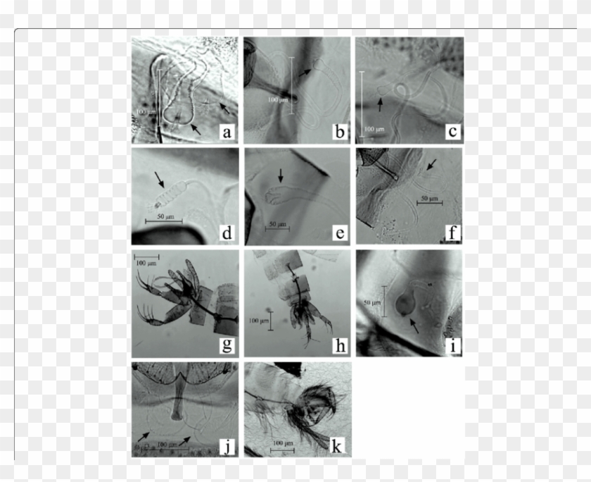 Genital Structures Of Lutzomyia Specimens From Isla - Monochrome Clipart