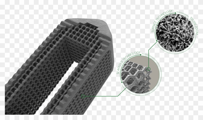 Of Porous Titanium Spinal Fusion Implants That Interweave - Mesh Clipart