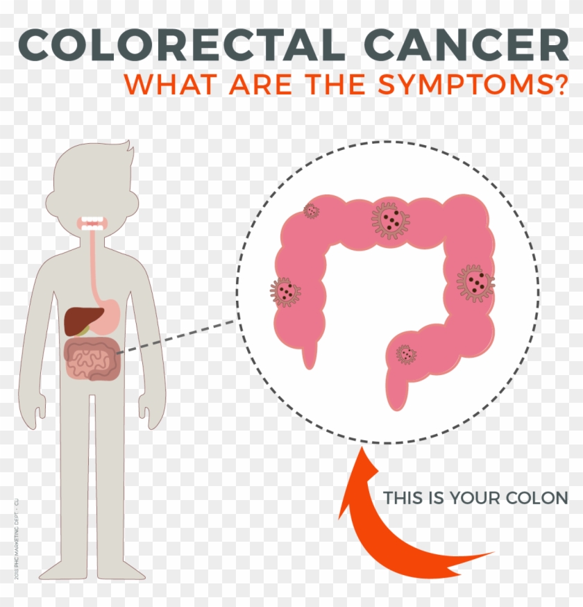 Symptoms Of Colorectal Cancer, The Body's Digestive - Human Body Clipart #5815043