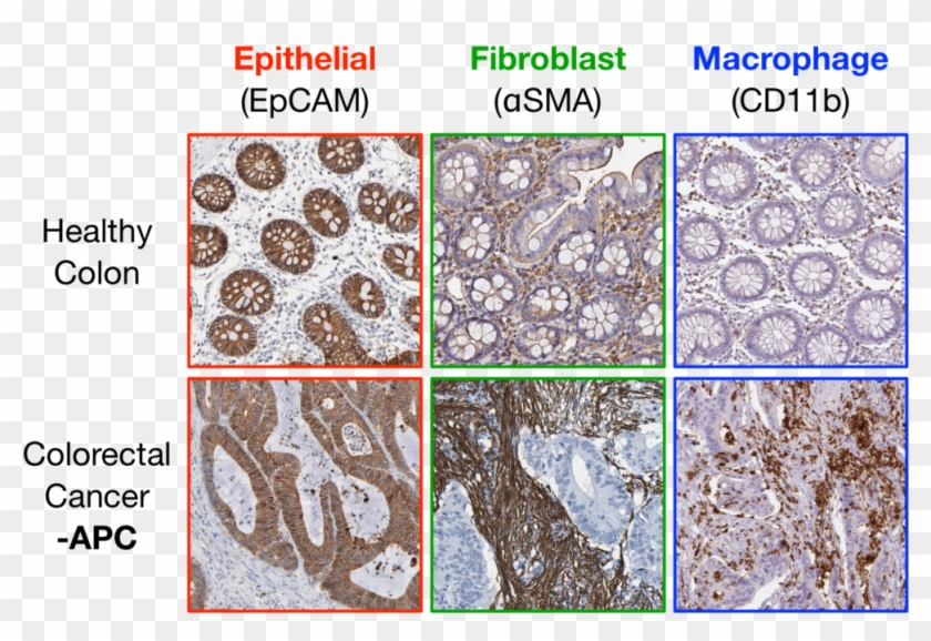 Figure 1 - Igneous Rock Clipart