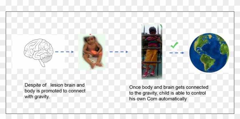Vasa Concpets Helps Child With Brain Lesion To Connect - Online Advertising Clipart #5826538