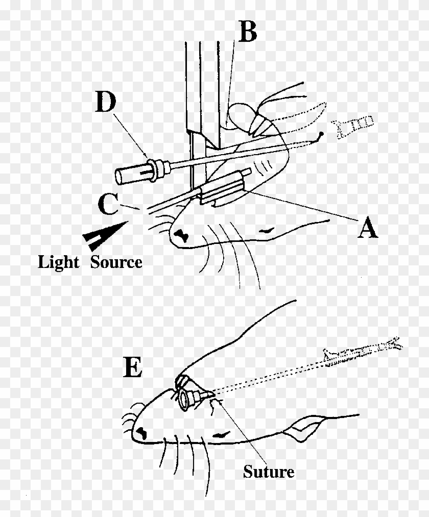 Placement Of The Laryngoscope - Line Art Clipart #5830706