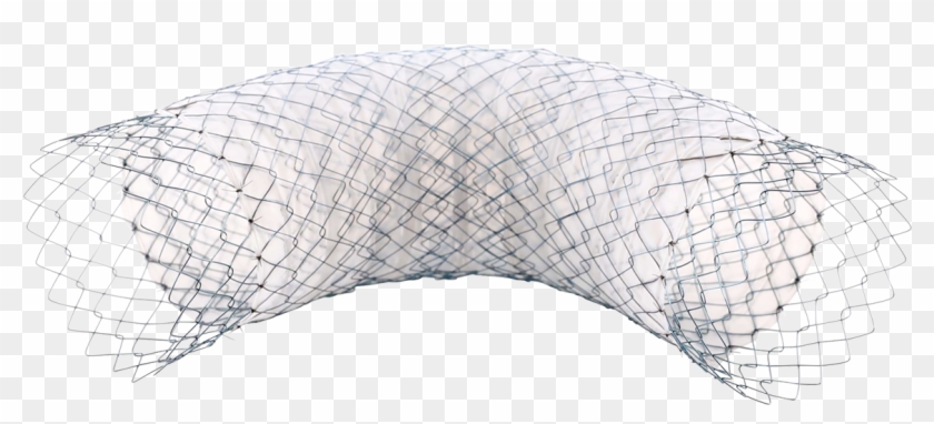 A - Partially Covered Self Expandable Metal Stents Clipart #5856416