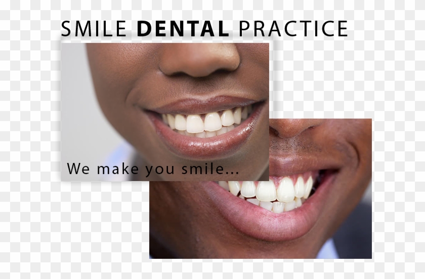 Smile Dental Group - Photo Caption Clipart #5864010