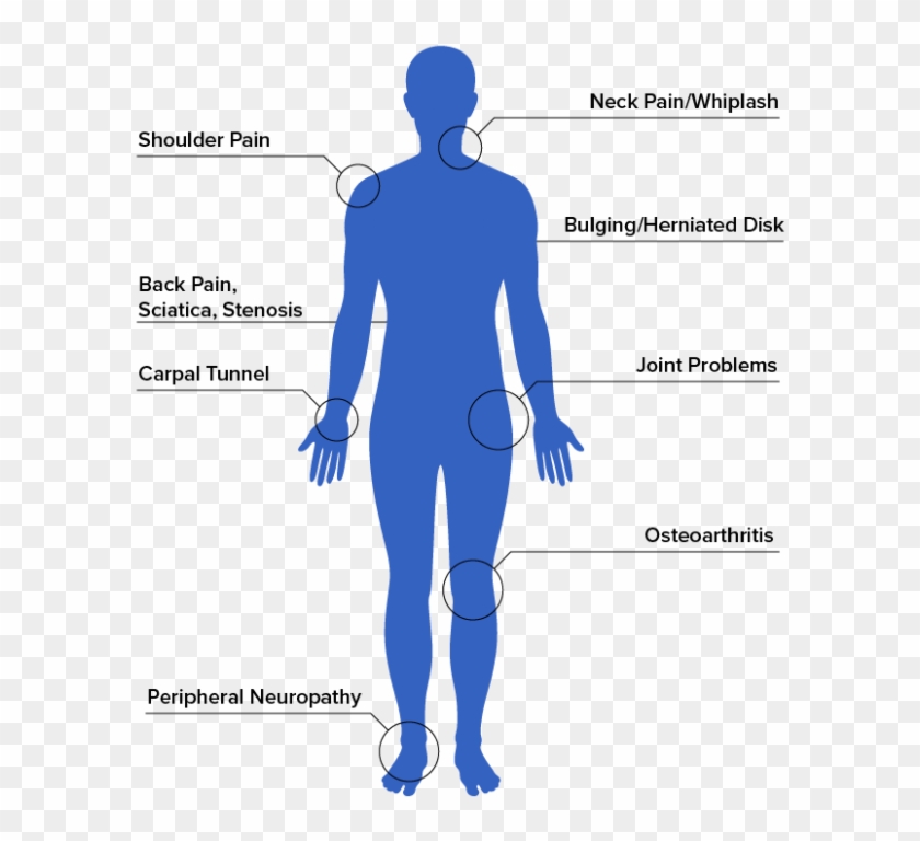 Symptoms We Treat For Pain Relief - Standing Clipart