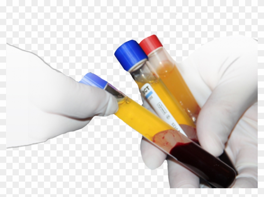 What Part Of The Face Can Prp Treat - بلازما الدم Clipart