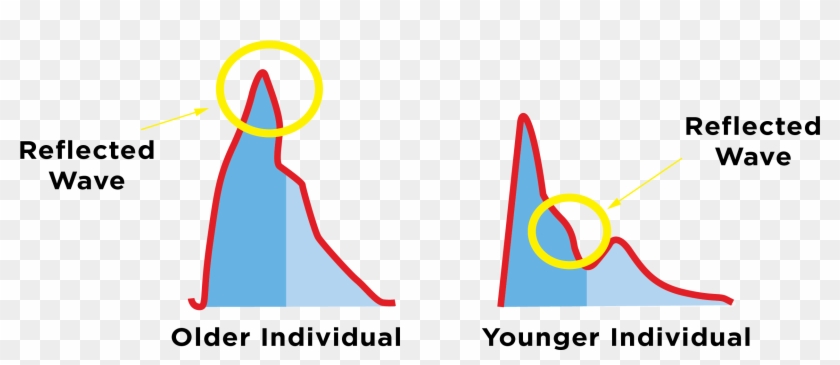 Pulse Wave Velocity Explained - Reflected Wave Heart Clipart