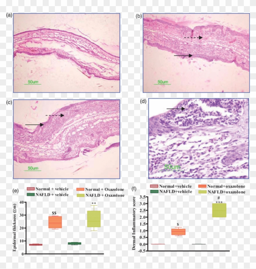 Effect Of Oxazolone On Ear Histopathology In Normal - Mouse Ear Inflammation Histo Clipart #5937034