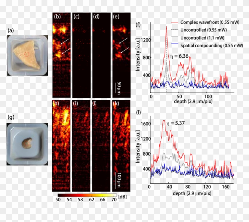 In Vitro Ws Oct Images Of The Chicken Breast And Mouse - Chicken Breast Optical Coherence Tomography Clipart