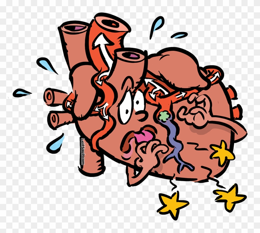 Heart With Obstructed Coronary Artery Clipart #5946325