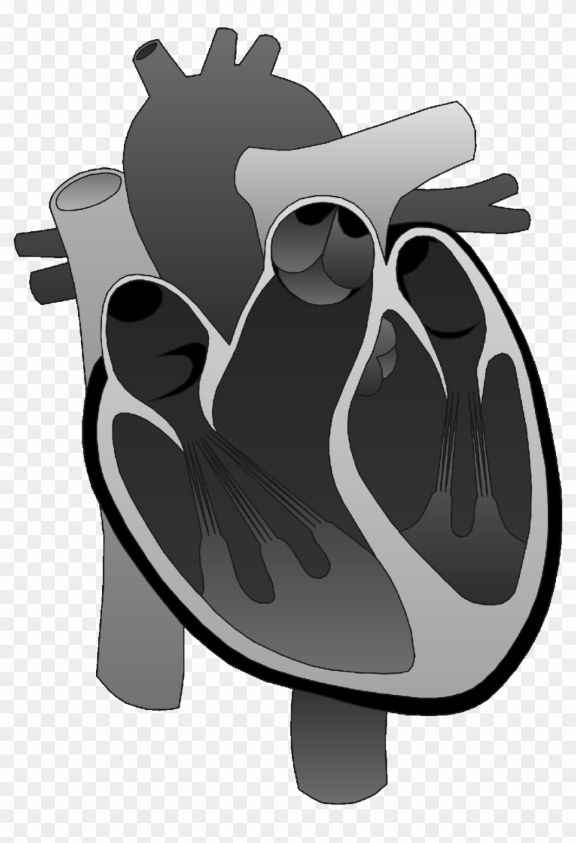 Cad Is The Commonest Variety Of Heart Disease, Which - Right Ventricle Outflow Tract Clipart