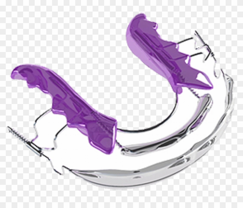 Appliances - Inman Aligner Spange Clipart