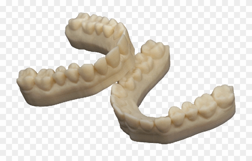 Dental Model By 3d Printing For Dental Crowns & Bridges - 3d Printed Dental Model Clipart #5976471