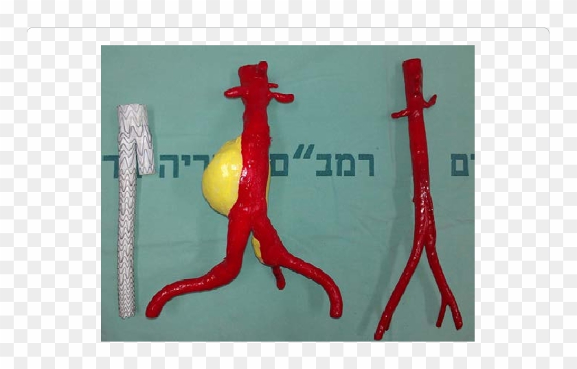 3d Models In Evar Planning - Giraffe Clipart