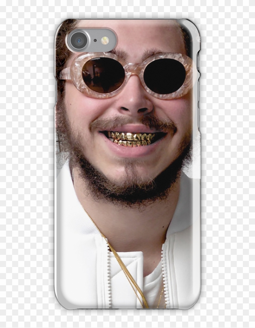 Post Malone Gold Grill Iphone 7 Snap Case - Congratulations Post Malone Meme Clipart