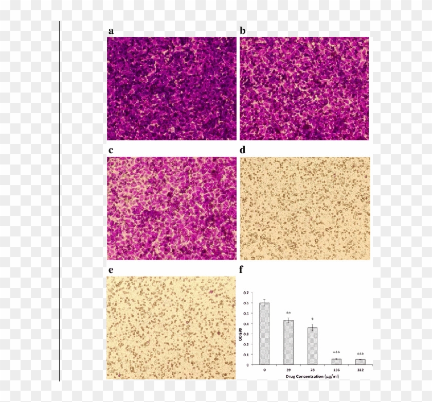 Effect Of Oridonin On Huvec Migration - Glitter Clipart #615941