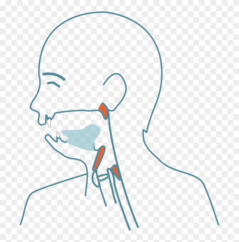 Abnormal Bite- And Jaw Development - Drawing Clipart #631695