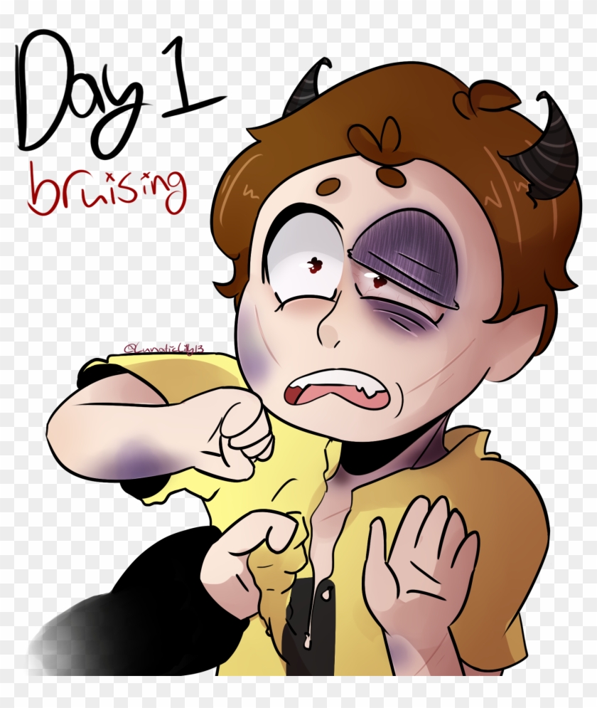 Goretober - Bruise In Clip Art - Png Download #643251