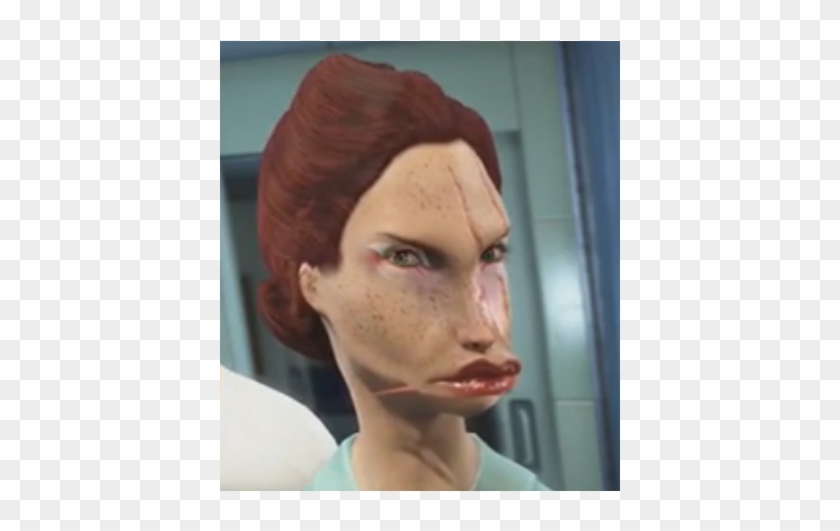 Uglyfallout - Ugly Fallout 4 Creation Clipart