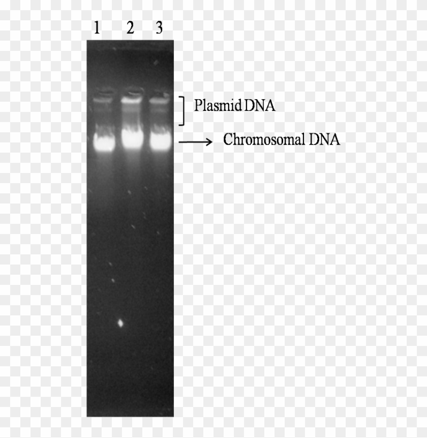 Electrophoresis Pattern Of Genomic Dna Of Clinically - Chromosomal Dna Gel Electrophoresis Clipart
