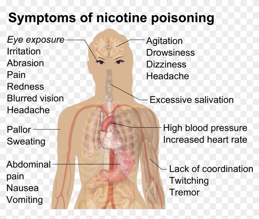 Symptoms Of Nicotine Poisoning - Nicotine Poisoning Symptoms Clipart