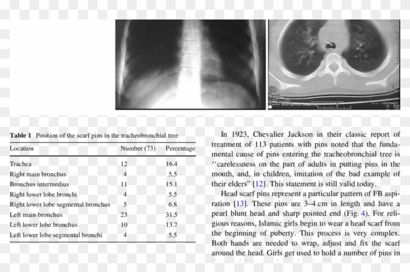 A Chest X-ray Showing Pin In The Thoracic Trachea, - Radiology Clipart #776031