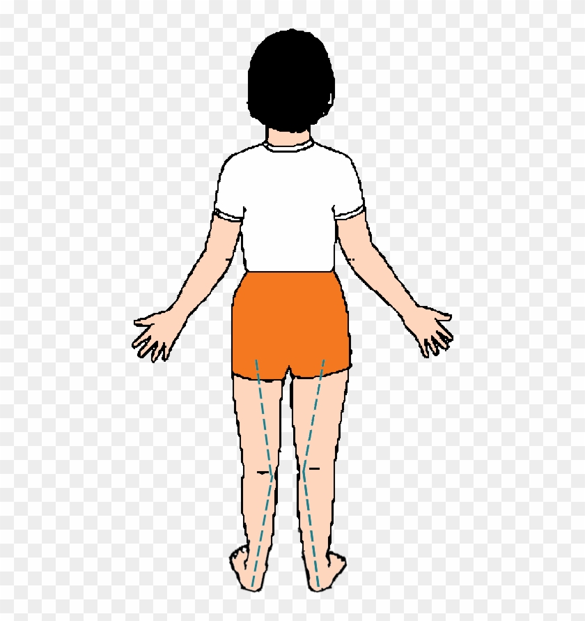 "over Pronation" Means That, As Your Child Walks They - Illustration Clipart