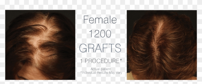 Her Journey - Women Diffuse Thinning Clipart