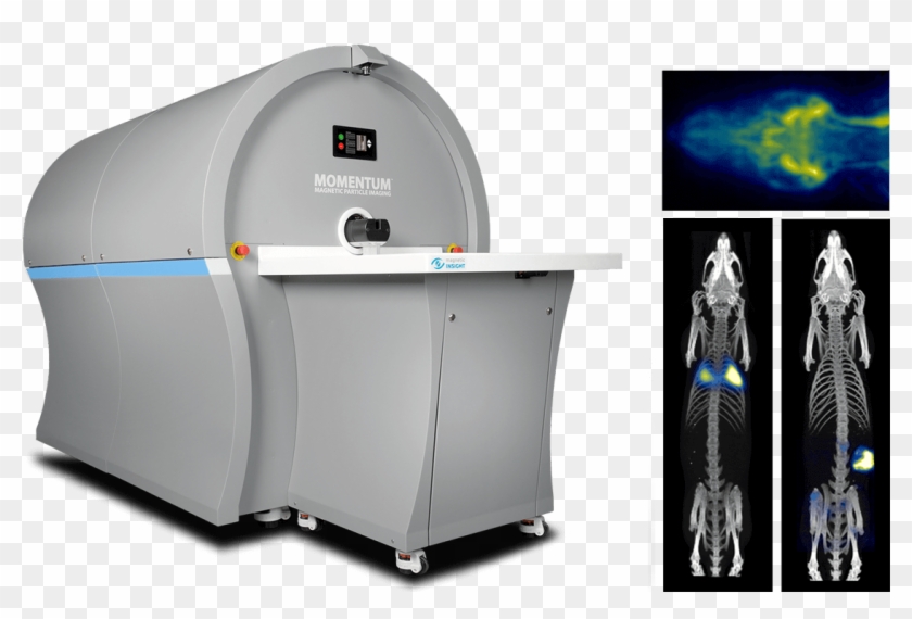 Neurovascular Perfusion And Blood Pool Imaging - Medical Imaging Clipart