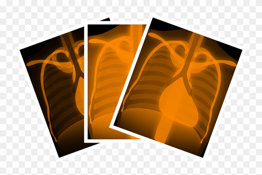 Innokas Medical Business Blog - Graphic Design Clipart #833411