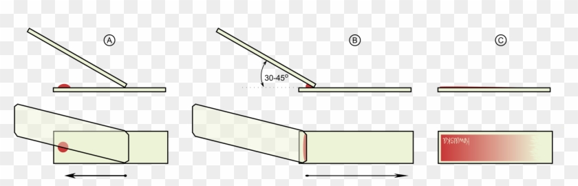 Open - Jak Zrobić Rozmaz Krwi Clipart #876770