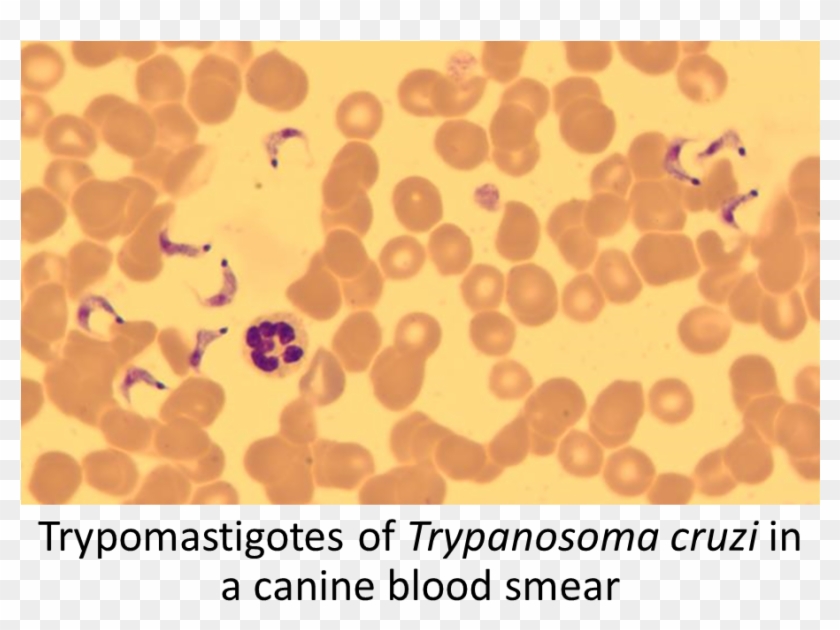 Trypanosoma Cruzi Method Of Diagnosis Find Amastigotes - Circle Clipart #877001