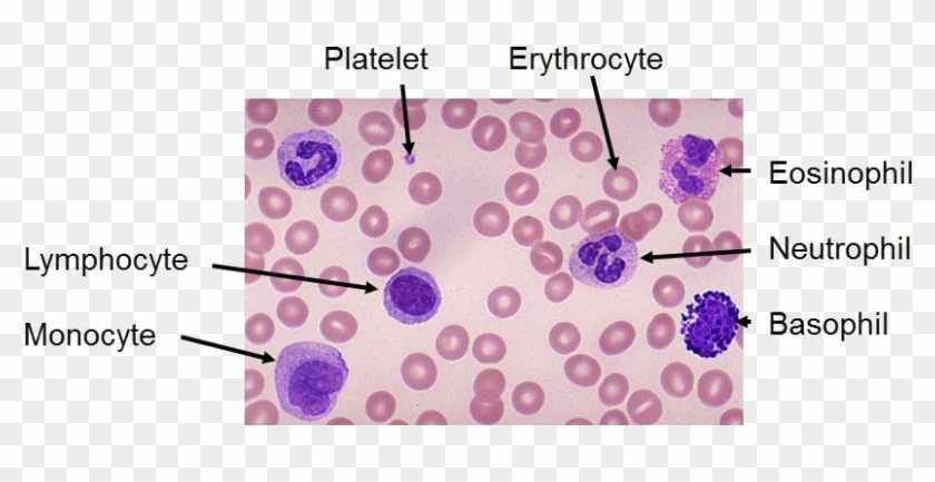 Blood Film - Neutrophil Vs Lymphocyte Clipart