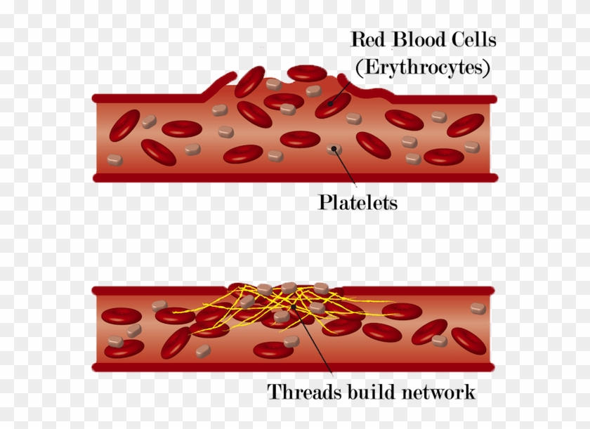 Collection Of Free Cellular Clipart Blood Clot - Children's Miracle Network Hospitals - Png Download