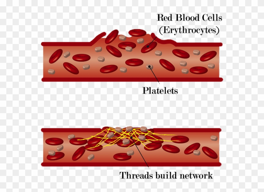 Collection Of Free Cellular Clipart Blood Clot - Children's Miracle Network Hospitals - Png Download #877983