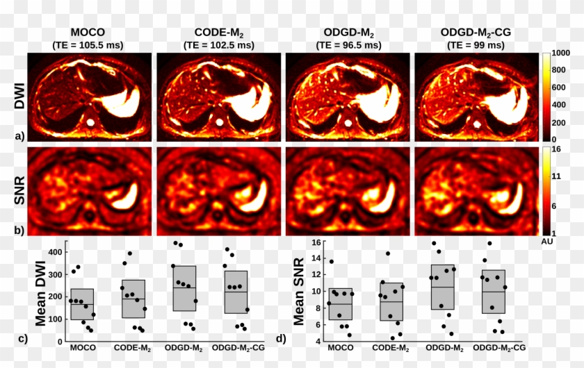 Optimized Diffusion-weighting Gradient Waveform Design - Graphic Design Clipart #883589