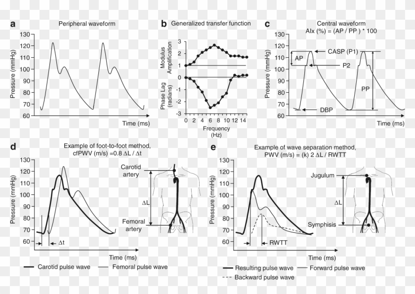 Method Of Pulse Wave Analisys - Cell Clipart