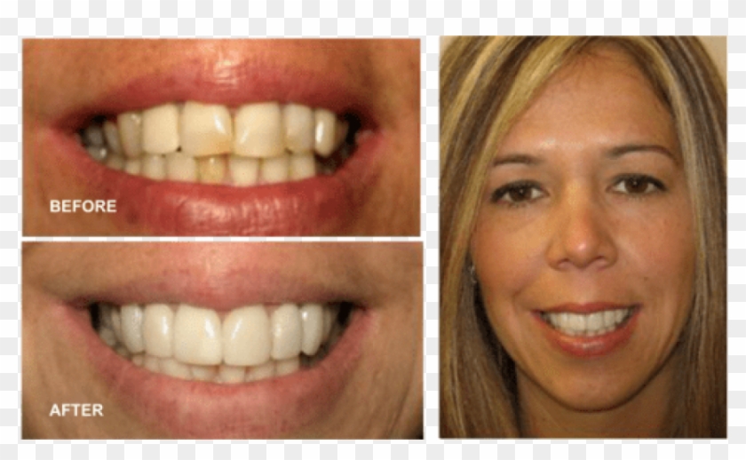 Free Png Download Dentist In Hicksville Png Images - Jaw Clipart