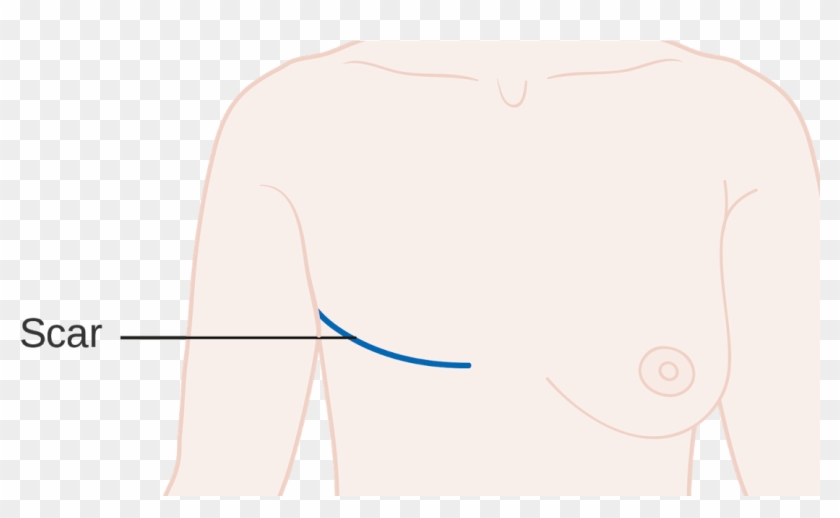“i Know Why I Have The Scars That I Do, And The Bottom Clipart